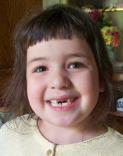 My two front teeth are gone! (May 10, 2010)